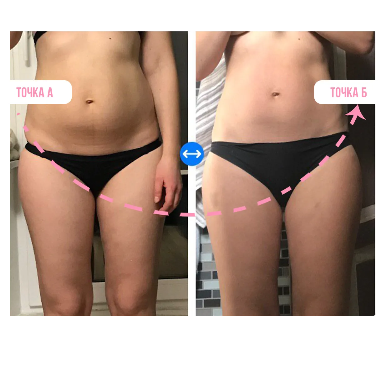 Результат ученицы — бёдра и живот до и после